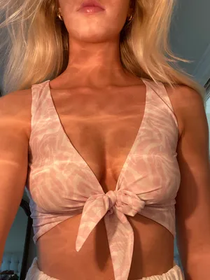Top thumbnail 1