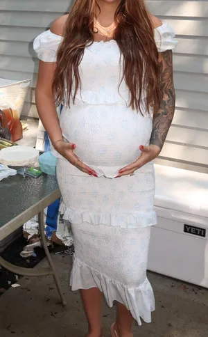 Worth Collective dress  thumbnail 1