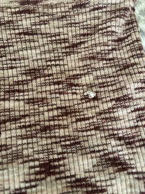 Garage skirt thumbnail 3