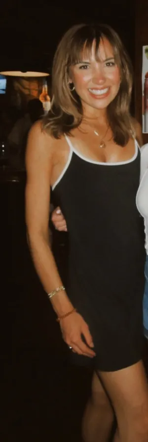 Abercrombie Mini Dress thumbnail 3