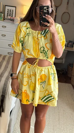 Sabo Yellow Pattern Mini Dress thumbnail 1