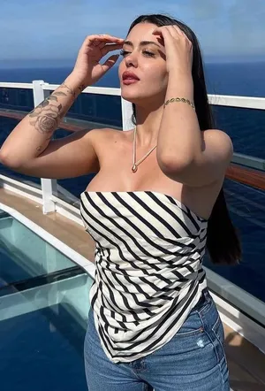 Zara Striped Bandana Tube Top thumbnail 1