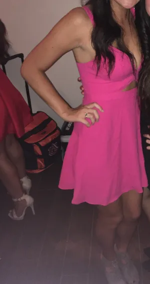 NBD dress thumbnail 3