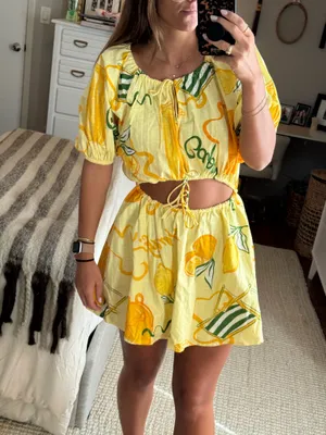 Sabo Yellow Pattern Mini Dress thumbnail 3