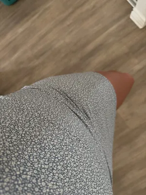 Abercrombie Dress thumbnail 4
