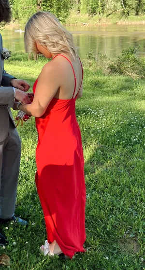 Amanda Uprichard Dress thumbnail 3