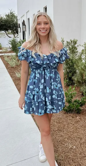 Abercrombie blue mini dress thumbnail 2