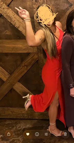 Abercrombie Dress thumbnail 4