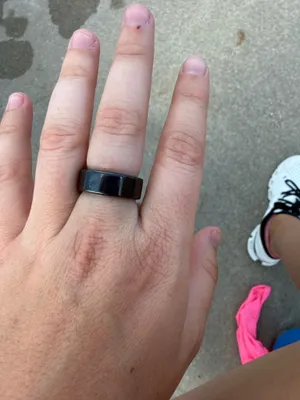 Oura Ring thumbnail 3