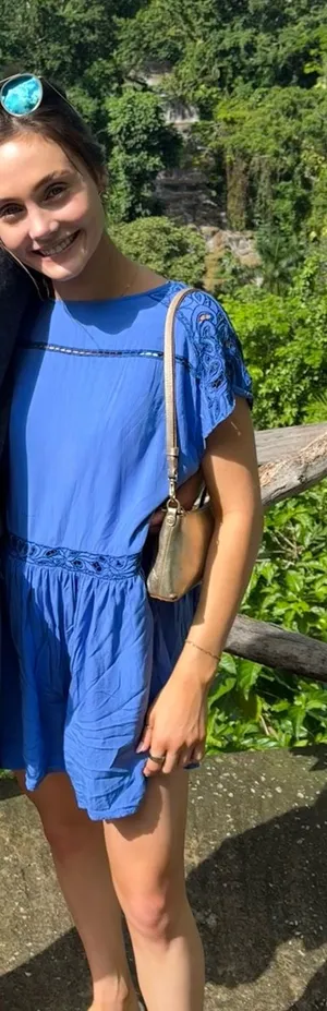 Free people dress thumbnail 1