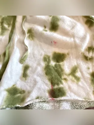 FREE PEOPLE Kelly Tie Dye shorts sweatshirt thumbnail 10