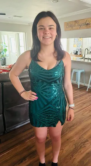 Lulus Homecoming Dress Green Dark thumbnail 1