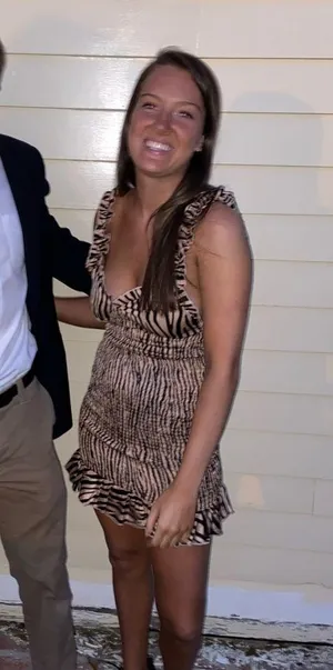 Zebra print mini dress! thumbnail 2