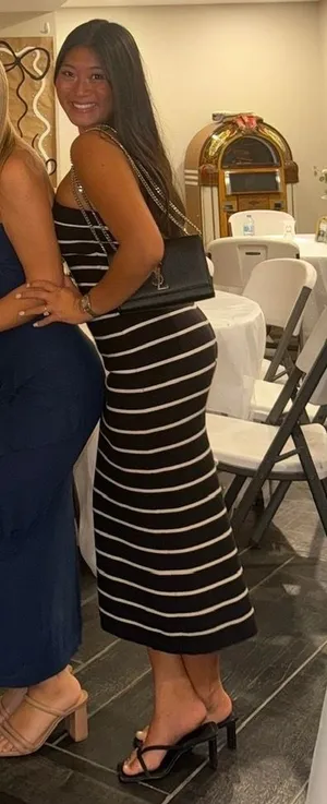 Abercrombie striped tube dress thumbnail 1
