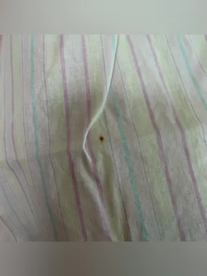 Vintage Lace Trim High Rise Boxer Shorts. Pastel Stripes. Size: XL. 100% Cotton. thumbnail 4
