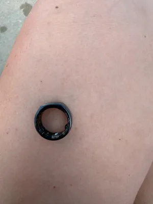 Oura Ring thumbnail 1