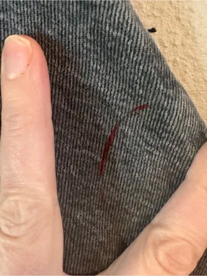ABERCROMBIE Loose HR‎ Denim thumbnail 7