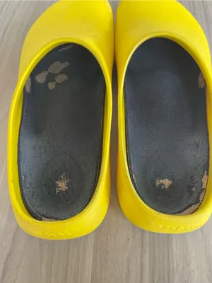 Birkenstock Yellow Slip-On EVA Clogs thumbnail 3