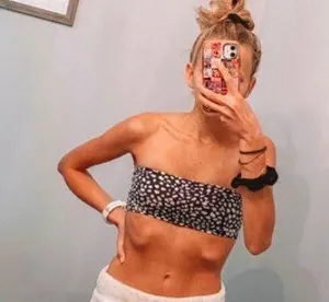 blackbough bikini top thumbnail 1