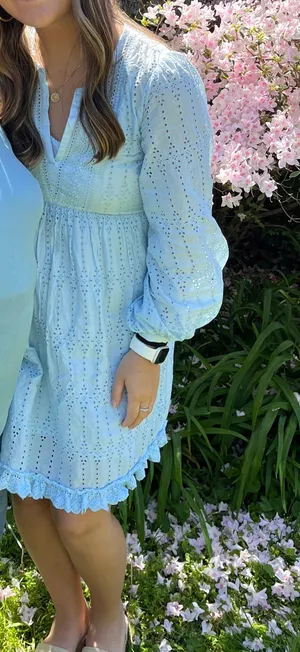 Anthropologie Dress thumbnail 1