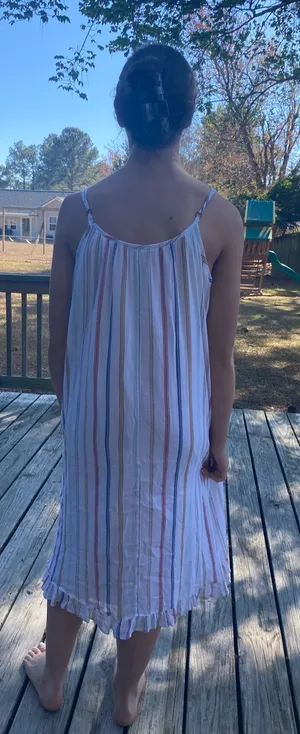 Stripes beach dress  thumbnail 2