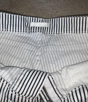 H&M black and white striped shorts thumbnail 4
