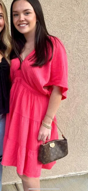 Aerie Dress thumbnail 2