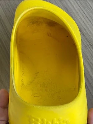 Birkenstock Yellow Slip-On EVA Clogs thumbnail 9