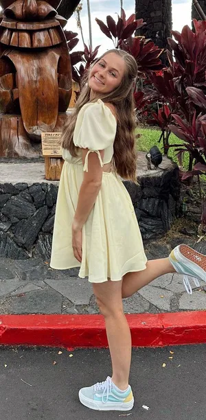 Lucy in the Sky Yellow Mini Dress thumbnail 4