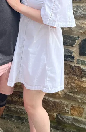 Abercrombie & Fitch Cutout Poplin Mini Dress thumbnail 2