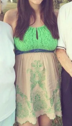 Flying Tomato Lace Printed Dress thumbnail 2