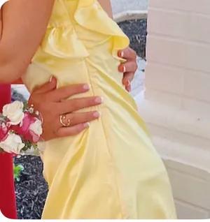 Yellow Homecoming Lucy in the Sky Dress thumbnail 3