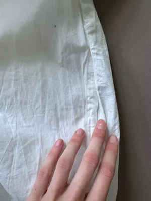 Asos Aware VM Stormi Oversized Button Up Shirt Dress thumbnail 6