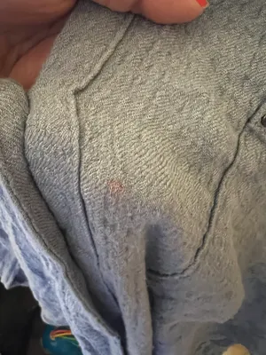 We The Free Oversize Blouse thumbnail 4