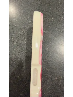 Hello Kitty Pink and White Phone Case 17 Pro thumbnail 4