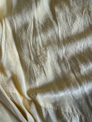 Yellow Sundress  thumbnail 2