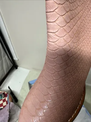 Croc thumbnail 6