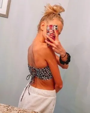 blackbough bikini top thumbnail 3