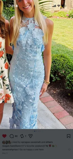 Light Blue floral lace midi dress thumbnail 3