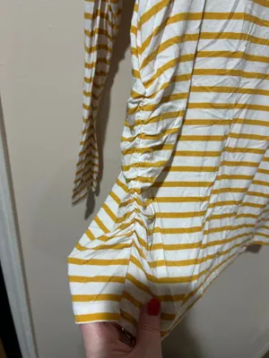 Aglow Yellow and White Striped Maternity Top thumbnail 2