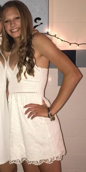 Abercrombie White Dress thumbnail 1