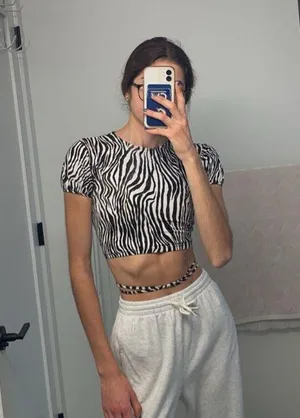 Motel Rocks Zebra crop top thumbnail 1