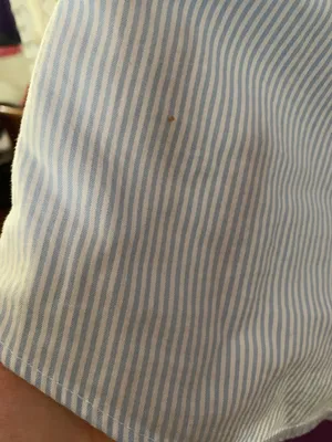 Tommy Hilfiger Button Up thumbnail 4