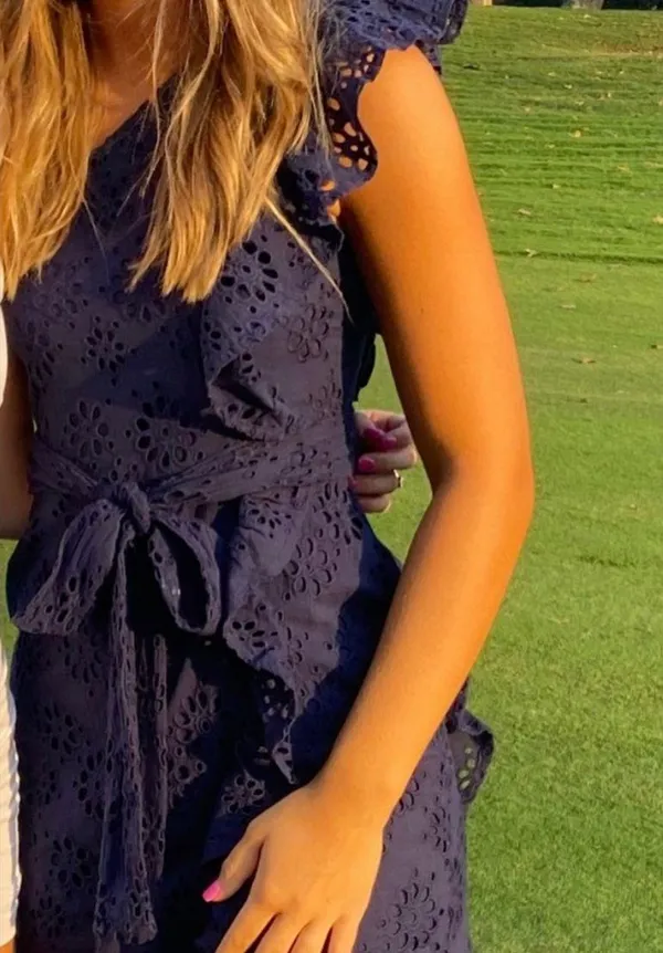 Lovers + Friends Dress - Image 2