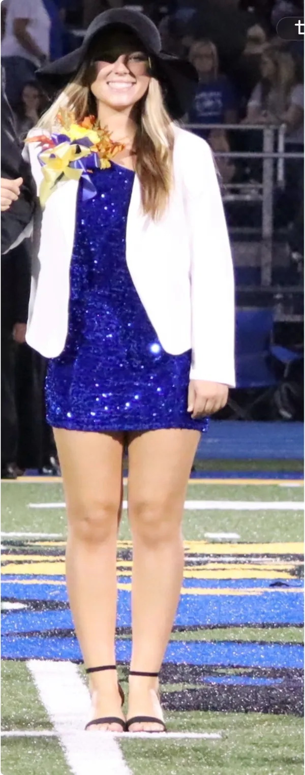 Sparkly Blue Homecoming Dress - Image 2