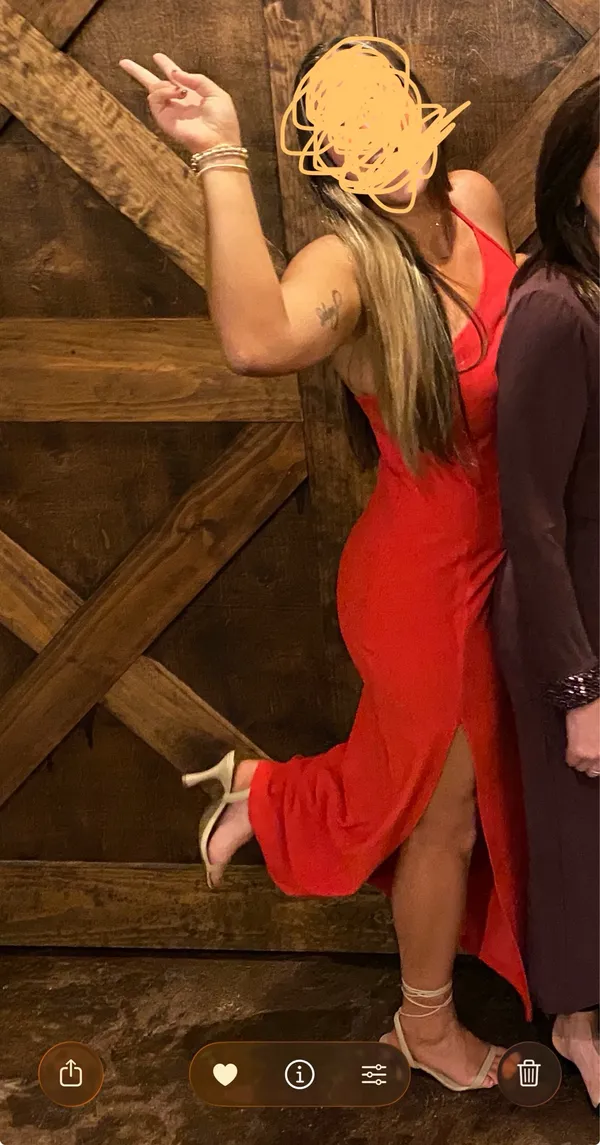 Abercrombie Dress - Image 4