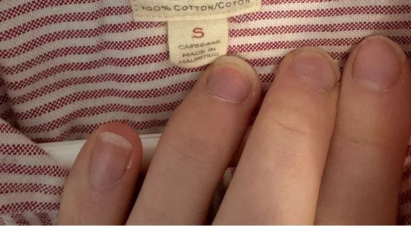 J Crew Classic Red Striped Button Down Shirt - Image 3