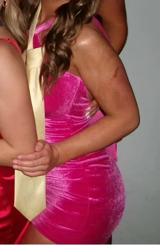 Pink superdown Mini Dress - Image 2