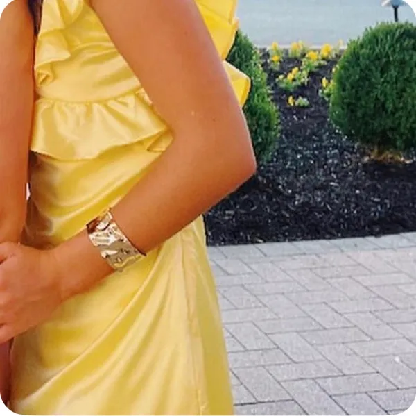 Yellow Homecoming Lucy in the Sky Dress - Image 2