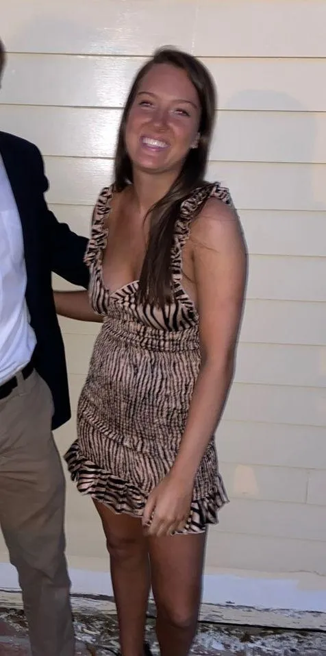 Zebra print mini dress! - Image 2